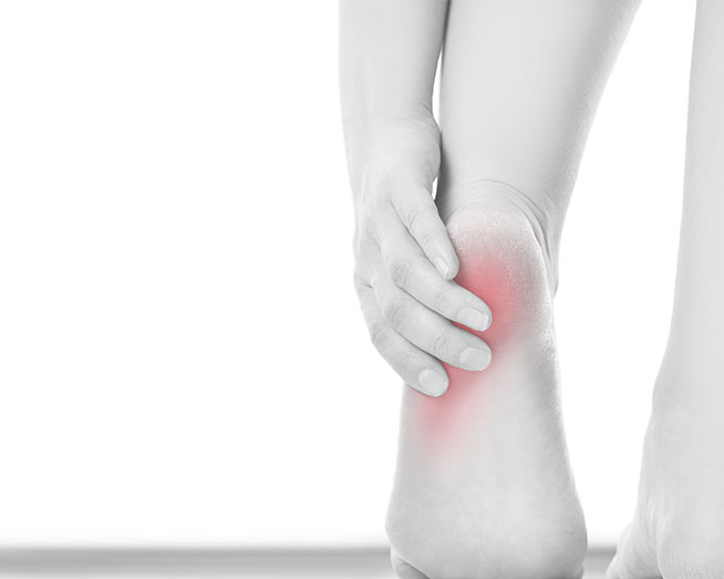 heel pain